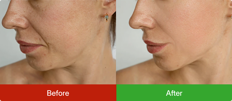 Before and after comparison of a woman's face with visible skin texture differences.